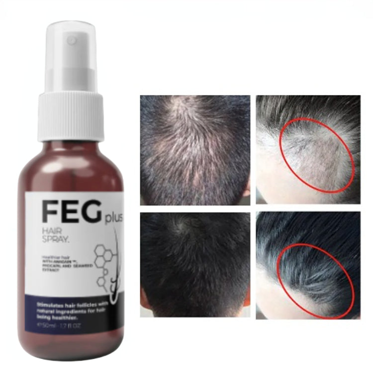 Le Spray Booster de Densité :Stoppez la chute, réactivez la pousse.